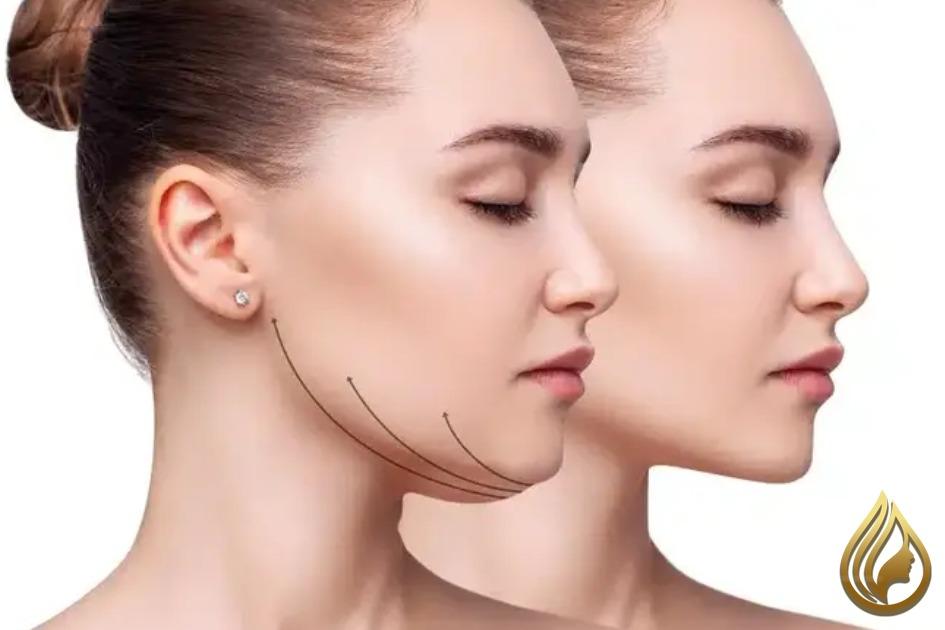 جای زخم لیپوماتیک غبغب باقی می ماند؟درمان ازبین بردن آن چیست؟